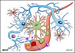 ilustracja medyczna, naukowa, anatomiczna - wizualizacja  komrek nerwowych, glejowcych i naczy krwiononych w stanie patologicznym - miadycowym